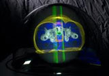 Radiation Oncology Radiation Oncology