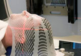 Radiation Treatment for Brain Cancer Radiation Treatment for Brain Cancer
